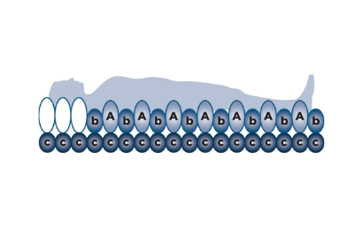 Picture of Alerta Ruby2 Replacement Alternating Mattress System, Very High Risk